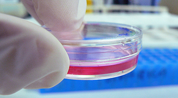 hand holding small petri dish with cell cultures